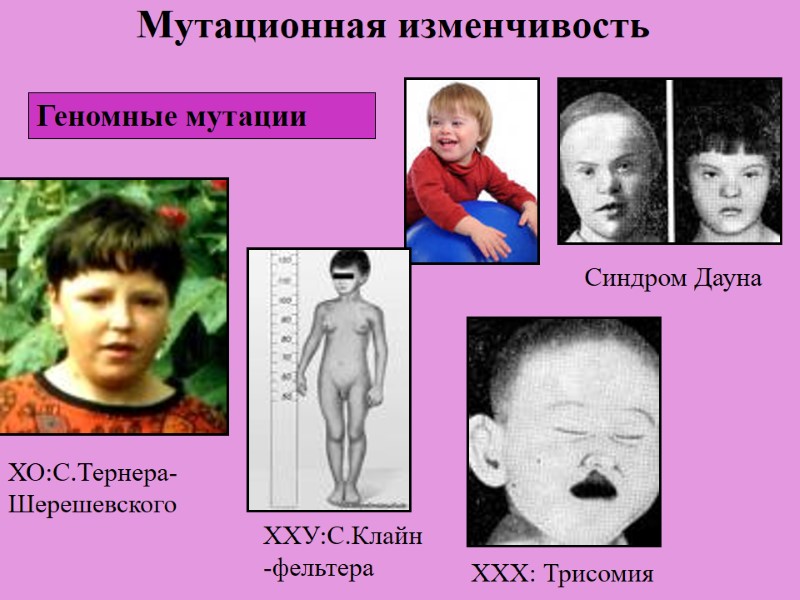 Мутационная изменчивость Геномные мутации ХО:С.Тернера-Шерешевского ХХУ:С.Клайн-фельтера  ХХХ: Трисомия  Синдром Дауна